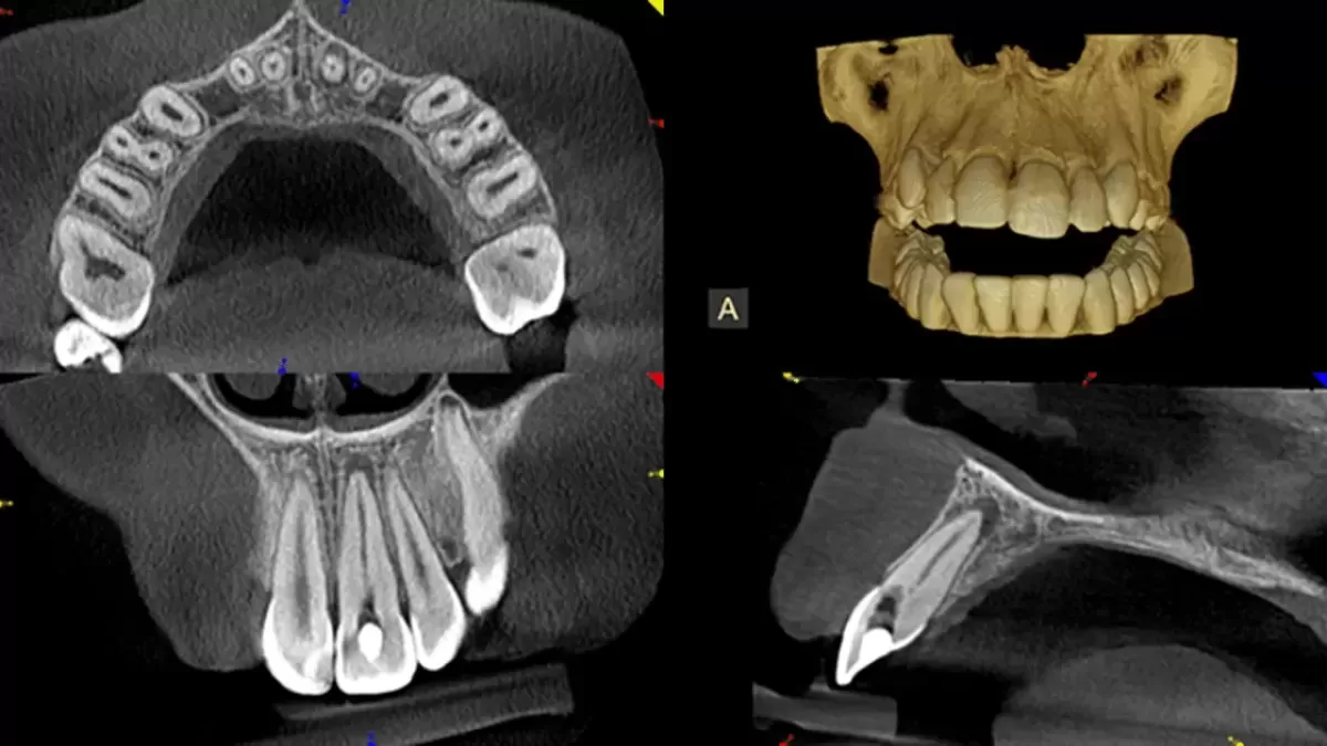 3D dijagnostika 